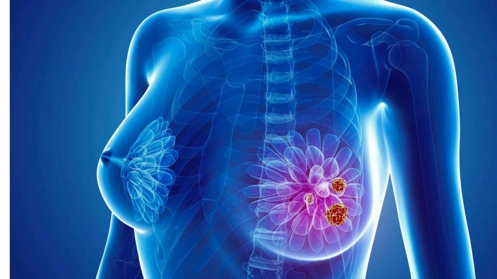 Anti Estrogen Apis Raw Steroid Powder Trilostane CAS 13647-35-3 for Breast Cancer